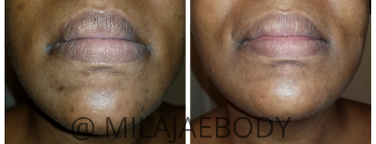 Turmeric Neem Facial Bar