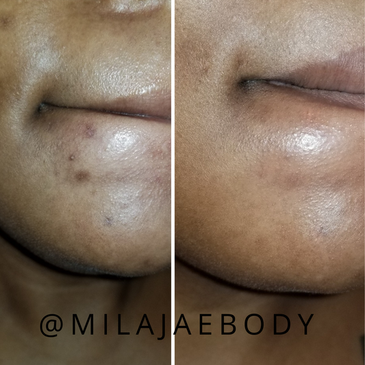 Turmeric Neem Body Bar